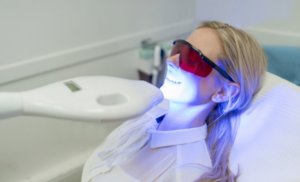 teeth whitening cape town specials