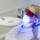 teeth whitening cape town specials