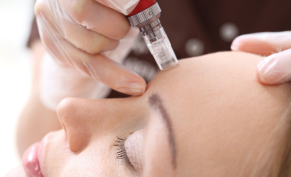 Improve skin appearance with a microneedling session and alginate mask