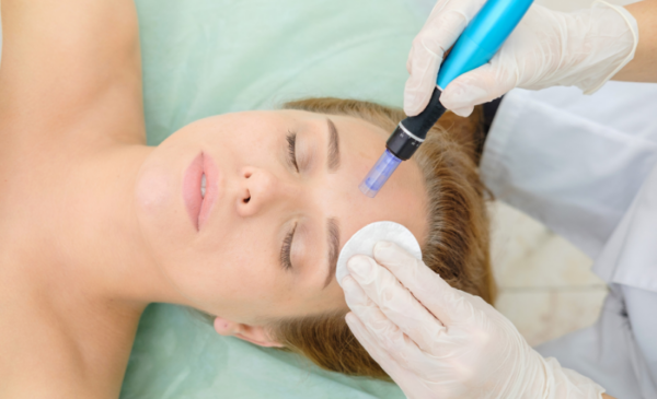 Reverse and prevent the signs of ageing with a microneedling session