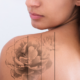 tattoo removal specials