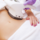 Lipo Laser session from Go Laser