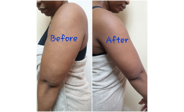Lose unwanted fat with this slimming package - Image 4