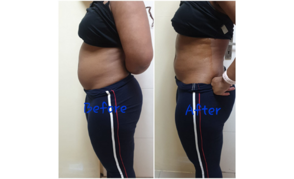 Lose unwanted fat with this slimming package - Image 5