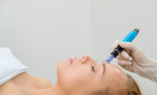 Choose microneedling for smoother skin