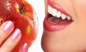 whiter teeth Embrace Dental Wellness home-kit dentist durbanville cape town