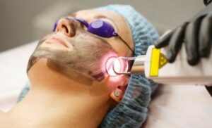 An E-light and Black Diamond Laser Treatment from jule beauty lounge