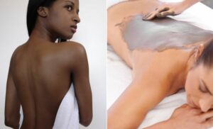 back exfoliation Umhlanga