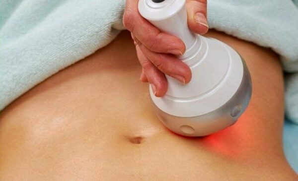 Laser Weight Loss Treatment in Cape Town - Image 2