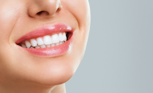 Get A Teeth Whitening Treatment in Cape Town