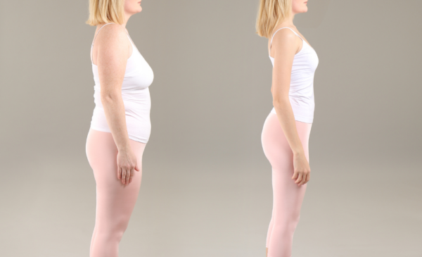 Lose Weight with A Cavitation Treatment in Cape Town