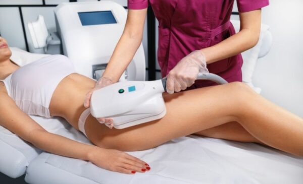 Get a Fat-Freezing Treatment That Works! - Image 2