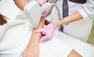 Laser hair removal sandton