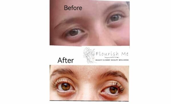 Get One of These Treatments at Home in Durban - Image 2