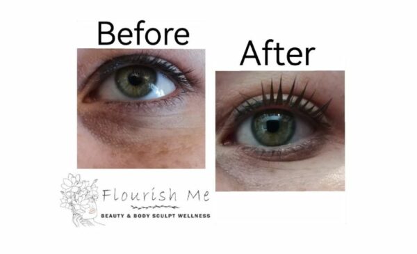 Get One of These Treatments at Home in Durban - Image 3