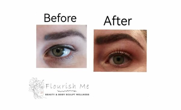 Get One of These Treatments at Home in Durban - Image 4