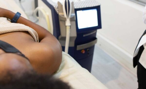 Get Laser Hair Removal in One Area in Milnerton - Image 6