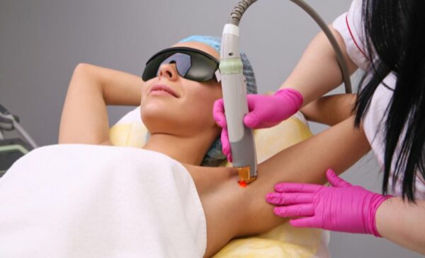 A Laser Hair Removal Session in Germiston
