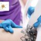 A Laser Tattoo Removal Session in Claremont