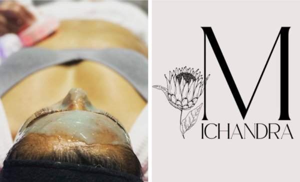 A Chemical Peel Package for 1 in Brackenhurst