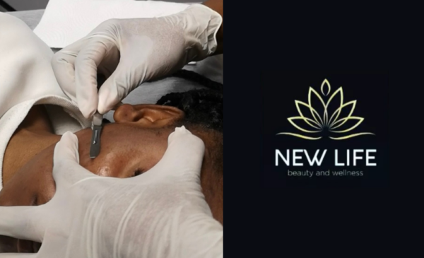 A Dermaplaning Session for 1 in Killarney