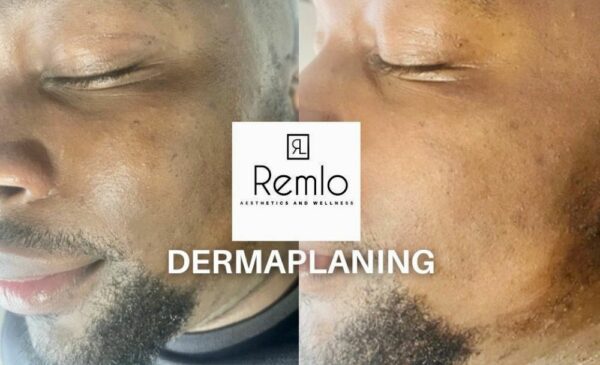 Smooth and Hydrate Your Skin with a Mini-Facial and Dermaplaning in Fourways