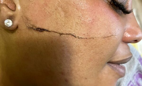 Smooth and Hydrate Your Skin with a Mini-Facial and Dermaplaning in Fourways - Image 2