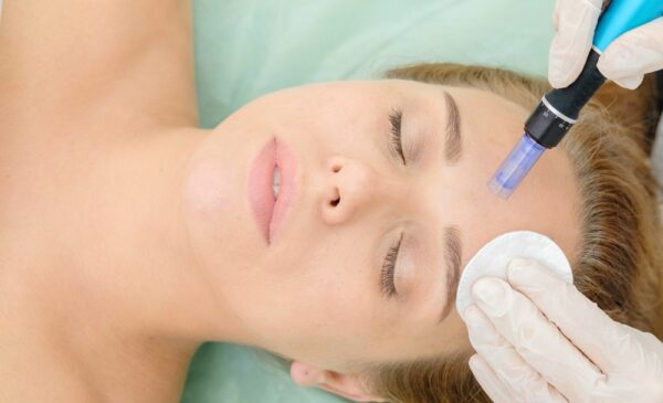 Microneedling with a Facial in Plattekloof or Tyger Valley