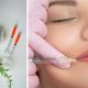 Lip Filler and a Brightening Peel in Durban North