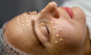A BB Glow and a Glycolic Peel in Umhlanga