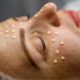 A BB Glow and a Glycolic Peel in Umhlanga