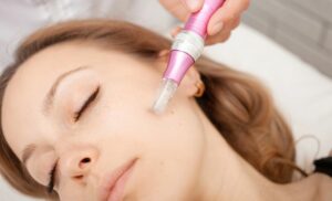 HydraPen Mesotherapy with a Retinol Booster in Brackenfell