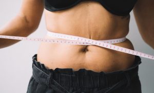 A person whilst receiving weight-loss treatments at SP Re-Shape in Randburg