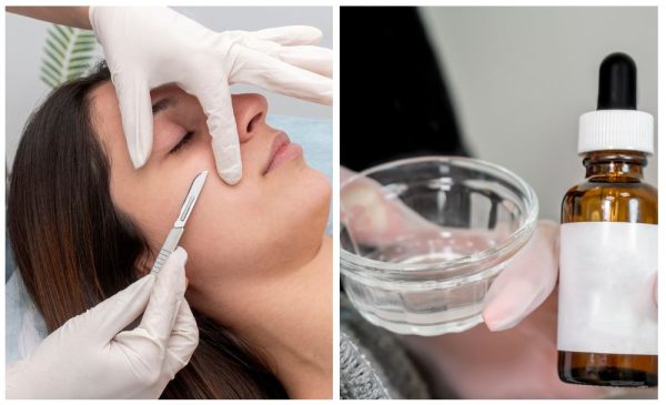 Remove Dead Skin with Dermaplaning and a Chemical Peel in Umhlanga