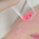 Laser Skin Rejuvenation Sessions at Oriental City Shopping Centre