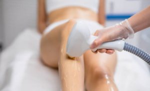 A stock photo of a woman having laser hair removal on her legs