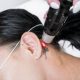 A stock photo of a woman undergoing laser tattoo removal