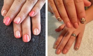 A Choice of Gel Overlays in Brackenfell