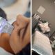 Microneedling and a Chemical Peel in Langebaan