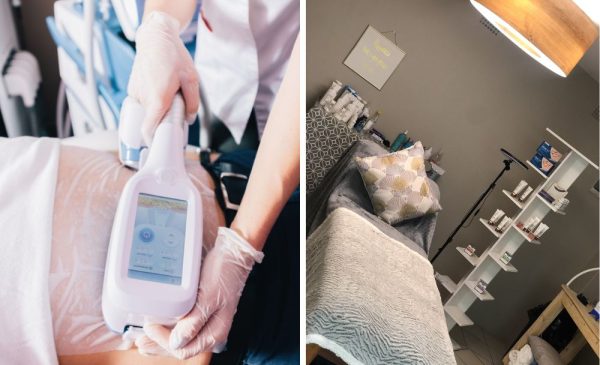 A Fat-Freezing Session in Langebaan