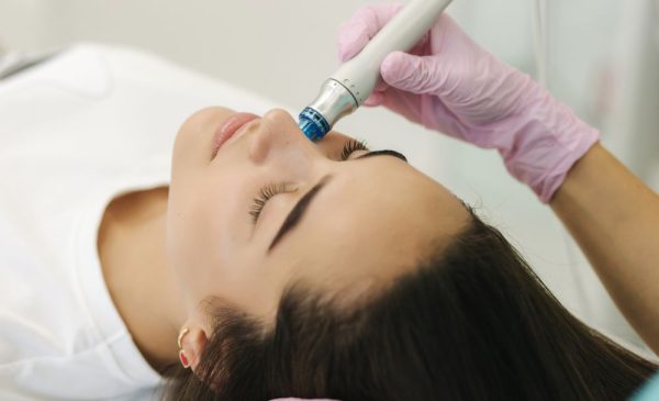 An Oxygen Peel Facial in Plattekloof or Tyger Valley