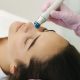 An Oxygen Peel Facial in Plattekloof or Tyger Valley