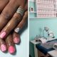 A collage of a gel fingers overlay and a treatment area at The Teal Orchid in Montclair