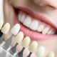 A stock photo of a woman after a professional teeth whitening session