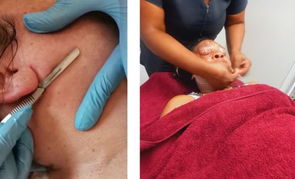 Enhance your skincare with this dermaplaning package for 1 in Sandton - Image 2