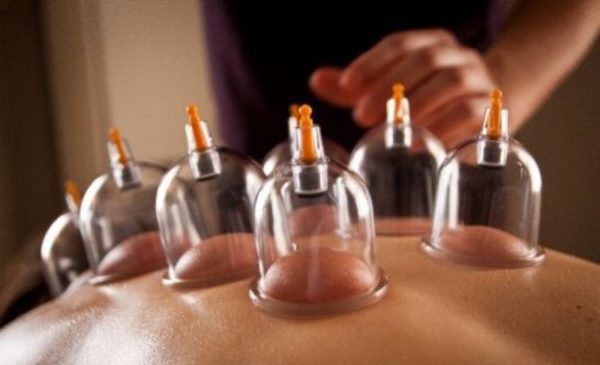 Relax with a cupping massage in Parklands