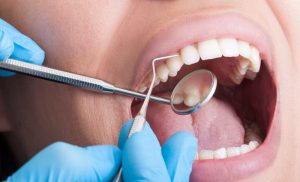 Dental consult