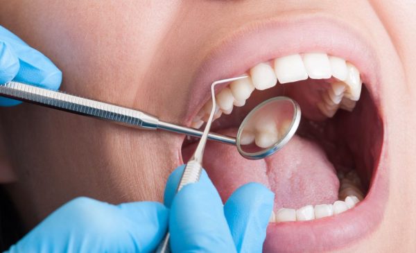 Dental consult