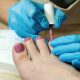 An Express Gel Pedicure in Durbanville