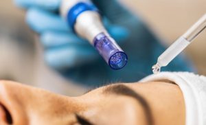 A Microneedling Combo in Durbanville